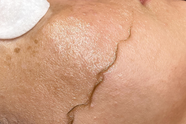 a close up of a tattoo