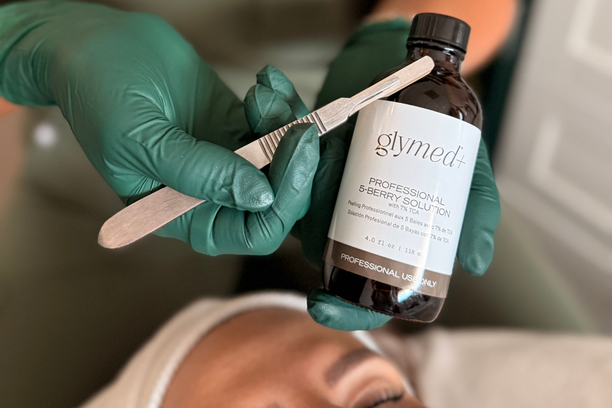 Professional chemical peel treatment at Honey Rose Aesthetics in Puyallup, WAProfessional chemical peel treatment at Honey Rose Aesthetics in Puyallup, WA